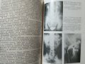 Инфекции на бъбреците и пикочните пътища 1980 г., снимка 2