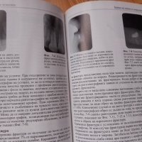 Дентални  рентгенови  снимки -интерпретиране, снимка 5 - Специализирана литература - 43920187