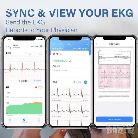 Преносим Bluetooth ЕКГ монитор с функция за анализ CheckMe , снимка 4 - Уреди за диагностика - 49772338