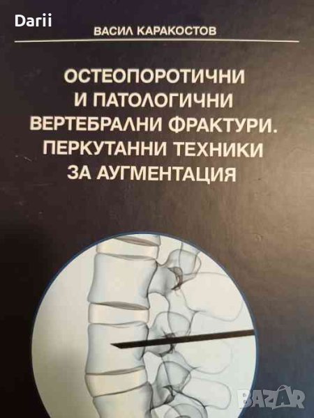 Остеопоротични и патологични вертебрални фрактури. Перкутанни техники за аугментация Васил Каракосто, снимка 1