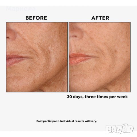 GLOPRO ИНСТРУМЕНТ ЗА МИКРОИГЛИ ЗА ЛИЦЕ , Microneedling Tool Kit, снимка 5 - Други - 40809430