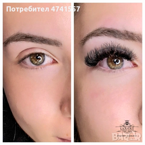 Курс за миглопластика Добрич