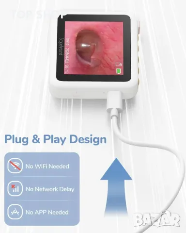 Медицински отоскоп с дисплей ScopeAround M28, снимка 3 - Медицинска апаратура - 49106096