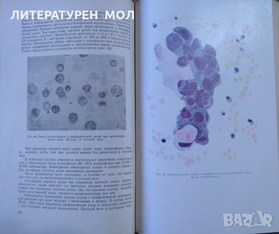 Руководство по внутренним болезням.Болезни печени и желчных путей/Болезни системы крови 1956-1959 г., снимка 4 - Специализирана литература - 26269590