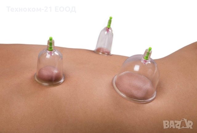 Вакуумни вендузи к-т 6 бр., снимка 4 - Други - 40839263