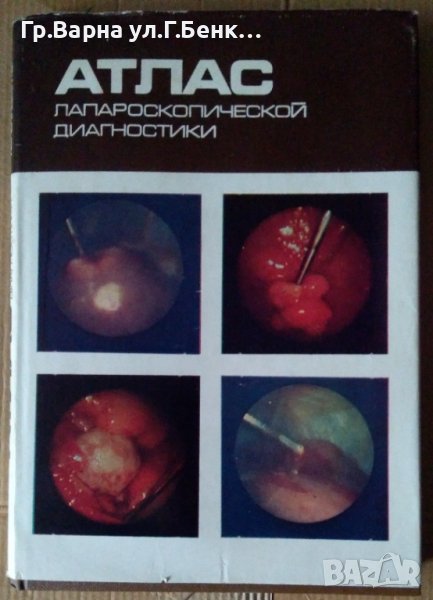 Атлас лапароскопической диагностики Коваль Е.Г., снимка 1