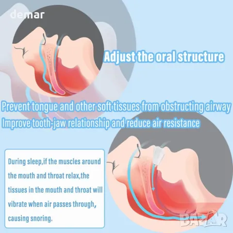AIOUTGOGO Удобно решение за спиране на хъркането, 2 броя, снимка 4 - Други - 50358940