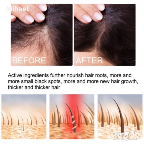 Многофункционален продукт за коса – растеж, заздравяване и сгъстяване, снимка 6 - Продукти за коса - 42951079