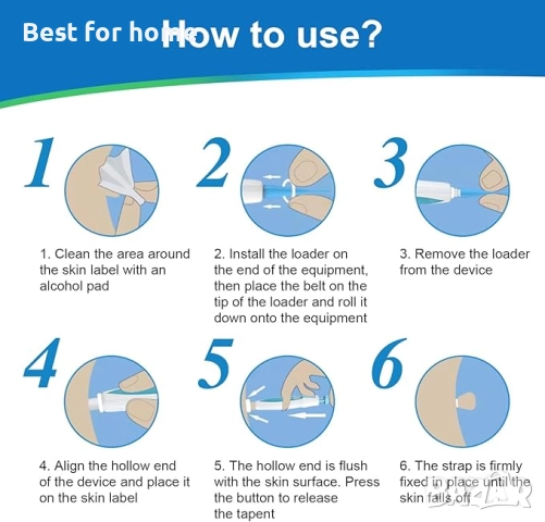 Kioiner Комплект за бързо и безопасно премахване на брадавици, снимка 6 - Други - 52987015