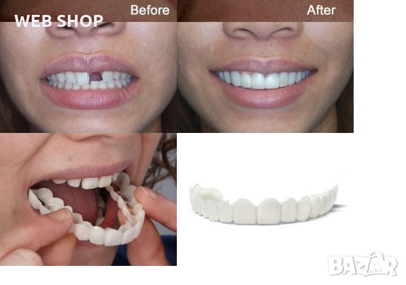 Перфектна усмивка с иновативната ПРОТЕЗА ЗА УСТА Snap-On Smile, снимка 1