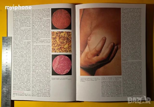 Стара Книга Обща медецина и Хирургия Ръководство за Хигиена, снимка 6 - Специализирана литература - 49429113