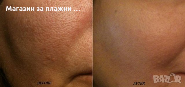 Четка за дълбоко почистване на лице PoBling , снимка 5 - Други - 28405234