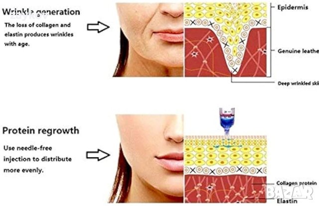 Хиалуронова писалка Писалка с хиалуронова киселина под високо налягане, снимка 3 - Друга електроника - 44115954