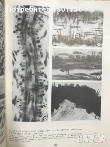 Микроангиология. Атлас Я. Л. Караганов, Н. В. Кердиваренко, В. Н. Левин, снимка 5 - Специализирана литература - 28785287