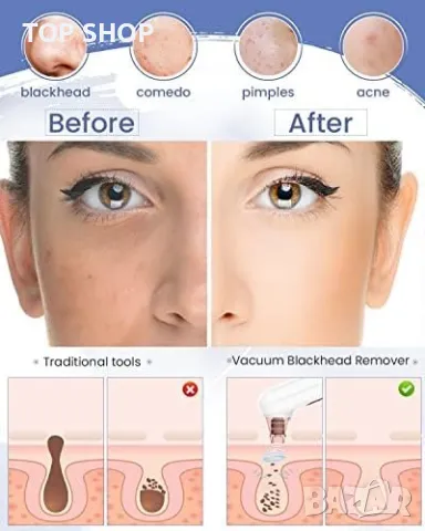 Нова Вакуум машинка за пори черни точки акне на лицето/USB/Жени Мъже, снимка 4 - Друга електроника - 49239141
