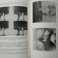 Томография на костите. Г. Хаджидеков, Б. Ботев 1957 г., снимка 2 - Специализирана литература - 27589751