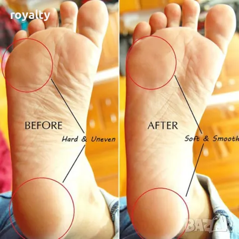 Уред за гладки пети и стъпала Instant Hard Skin Remover, снимка 2 - Други - 49183446