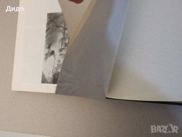 Рентгенодиагнистический атлас. Том 2: Болезни внутренних органов, снимка 11 - Специализирана литература - 39227598