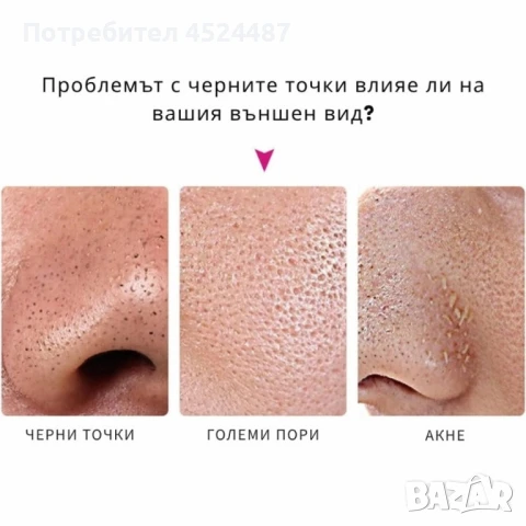 10 броя ленти за премахване на черни точки Nose Mask, снимка 7 - Други - 51202732