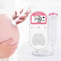 Фетален доплер, фетален монитор, сърдечен ритъм на бебе, тонове бебе, снимка 2 - Други - 27968416