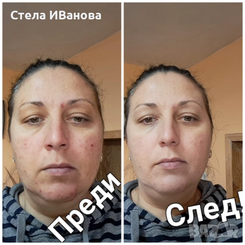 Крем за скриване на несъвършенства, петна и акне - маскира, хидратира. По-добър от фон дьо тен