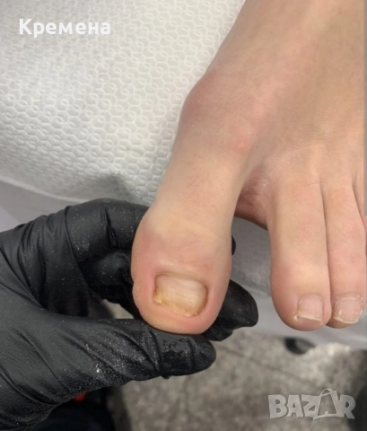 медицински педикюр Пловдив център