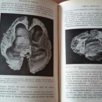Нервни болести Хенри Клод на френски , снимка 8 - Специализирана литература - 27903262