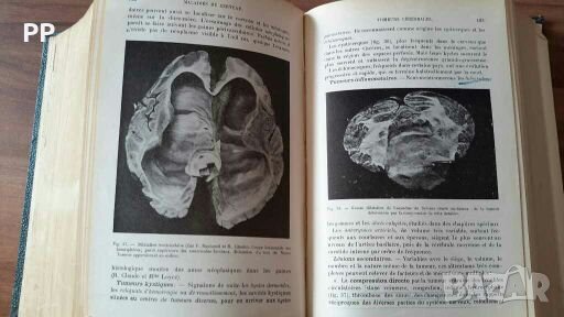 Нервни болести Хенри Клод на френски , снимка 8 - Специализирана литература - 27903262