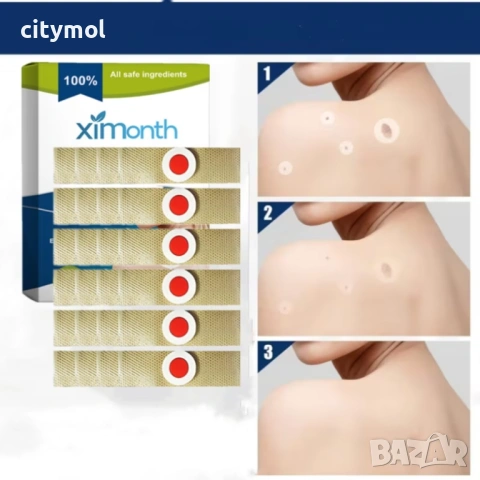 XIMONTH лепенки за премахване на петна, нежни и недразнещи, подходящи за всички части от тялото - ун, снимка 8 - Други - 53527148