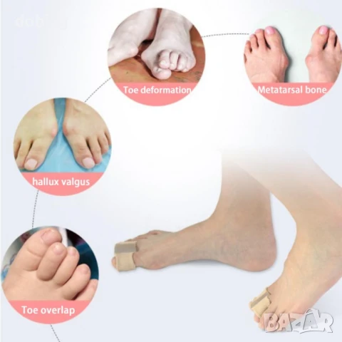 Силиконов разделител за пръстите на краката, коректор за корекция на палеца, снимка 3 - Други - 50946175