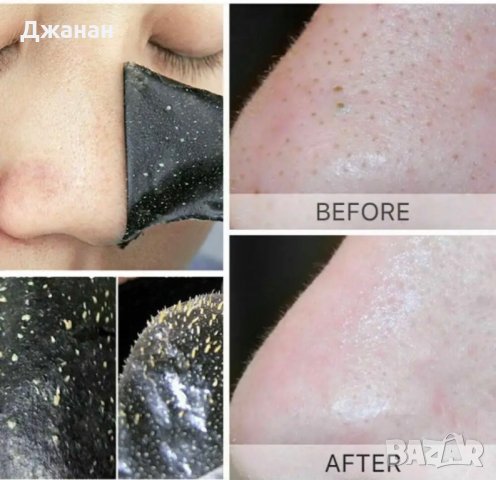 Почистваща лепенка за нос, снимка 3 - Козметика за лице - 43821734