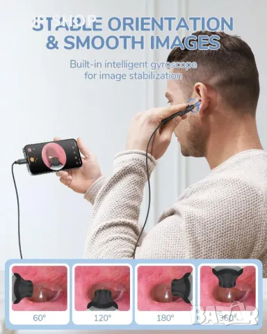 ScopeAround Камера за уши с отоскоп, за отстраняване на ушна кал, съвместим с iPhone 15/ Android, снимка 7 - Тримери - 49333002