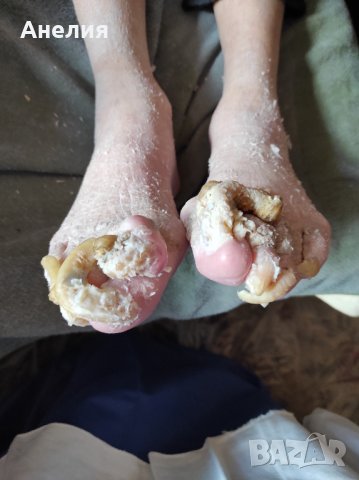 Медицински педикюр по домовете , снимка 16 - Медицински, стоматологични - 24454918