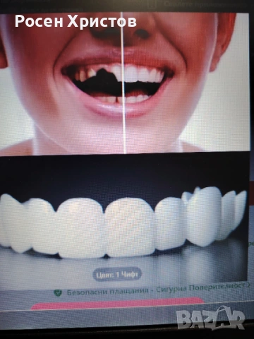 Горни зъби и Долни зъби в опаковка, снимка 3 - Други - 53047247