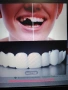 Горни зъби и Долни зъби в опаковка, снимка 3