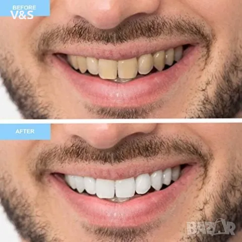 Комплект гел за избелване на зъби Meawhite - Професионално качество - Патентована формула , снимка 7 - Други - 48666183