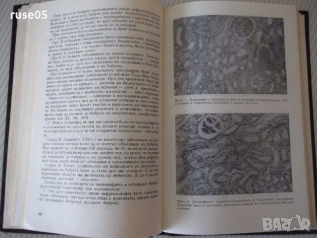 Книга "Болести на единствения бъбрек-Т.Патрашков" - 208 стр., снимка 6 - Специализирана литература - 40456612