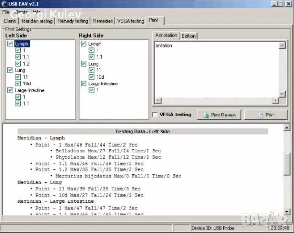 Biopulse*Вега тест*меридиан тест*терапия по EAV, снимка 4 - Уреди за диагностика - 51686016