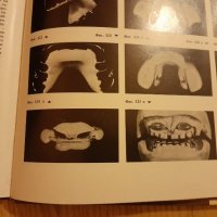 Атлас по Ортодонтия - 1988 год., доц. Декова , 130 страници, снимка 4 - Специализирана литература - 42783069