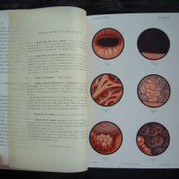 Медицинска книга Изследване на уринарната система, 1909 , френска, снимка 12 - Специализирана литература - 33406019