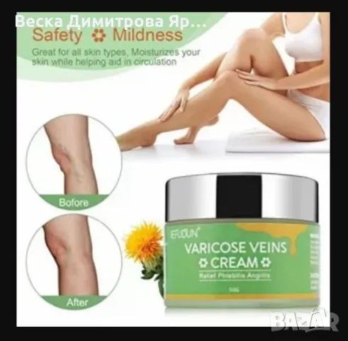 Лечебен крем с 6 билки за разширени вени и проблеми с краката HZS02, снимка 4 - Козметика за тяло - 47729574