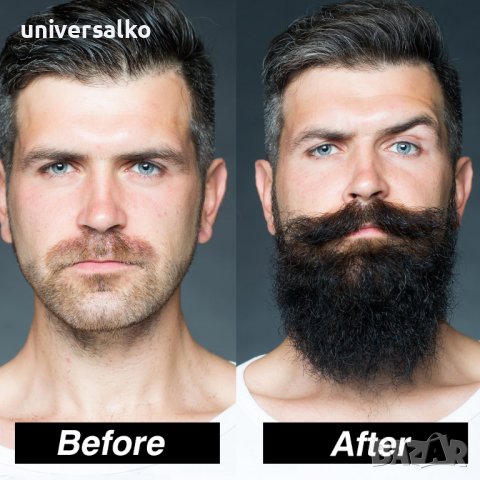 Мъжки комплект за растеж на брада Ускорител за растеж на косата, снимка 8 - Мъжка козметика - 39776833