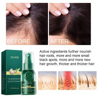 Многофункционален продукт за коса – растеж, заздравяване и сгъстяване, снимка 5 - Продукти за коса - 43559489