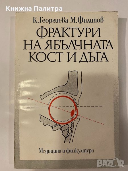 Фрактури на ябълчната кост и дъга , снимка 1