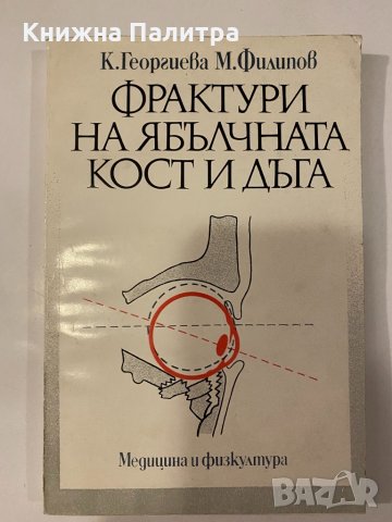 Фрактури на ябълчната кост и дъга 