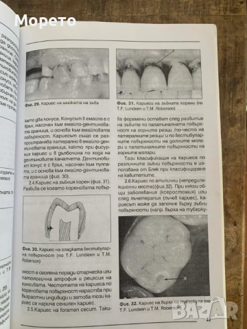 Кариесология и оперативно зъболечение, снимка 8 - Специализирана литература - 52863911