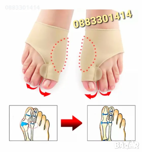 Намаление! Комплект Коректор за пръстите на краката , снимка 1