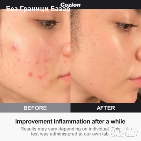 Нова Червена LED лампа 660nm за лице и тяло терапия релаксация красота, снимка 4 - Други - 52742380