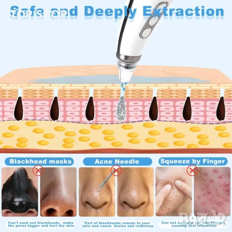 Vacuum blackhead remover премахване на черни точки, USB акумулаторен екстрактор на пъпки Tibobo, снимка 3 - Тримери - 48872982