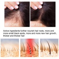Многофункционален продукт за коса – растеж, заздравяване и сгъстяване, снимка 5 - Продукти за коса - 43527741